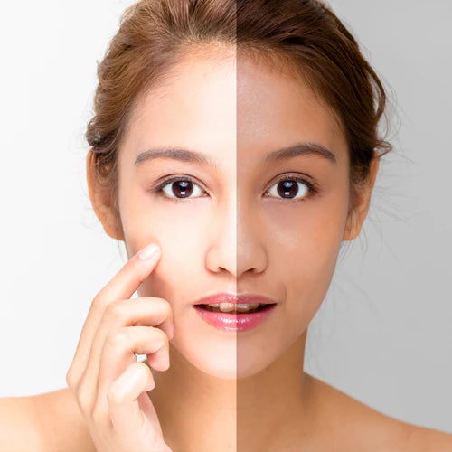 Whitening